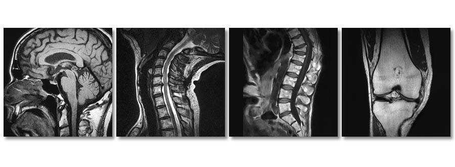 StandUp MRI of Wantagh